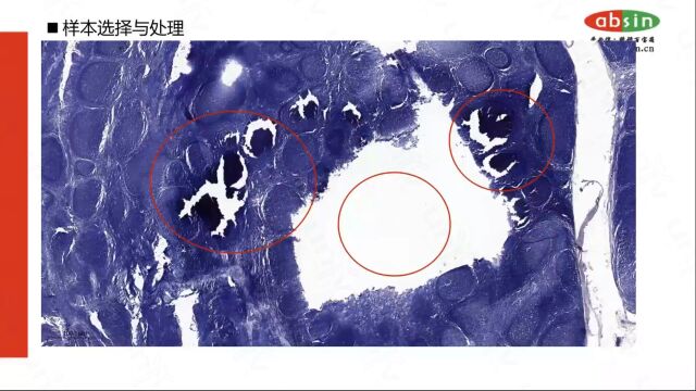 多重荧光免疫组化染色实战篇