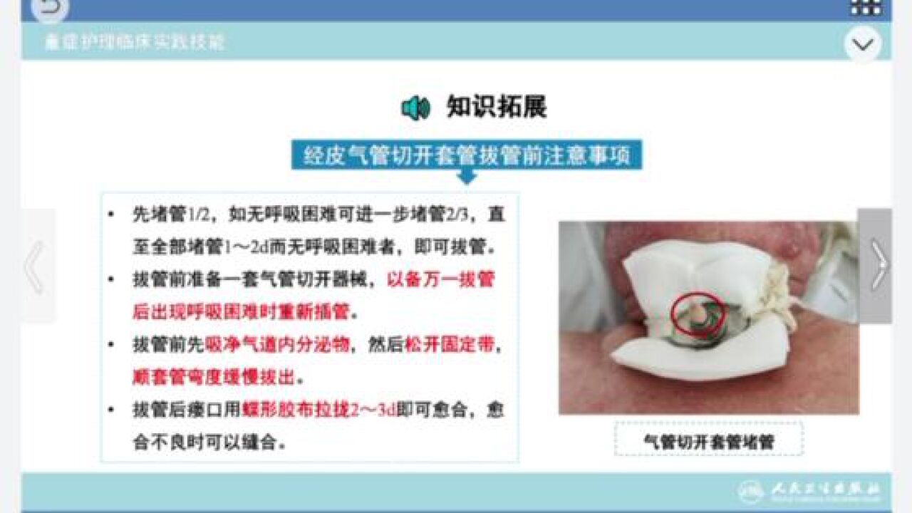 气管切开配合技术-护理操作技能教学示范-_高清1080P在线观看平台_腾讯视频