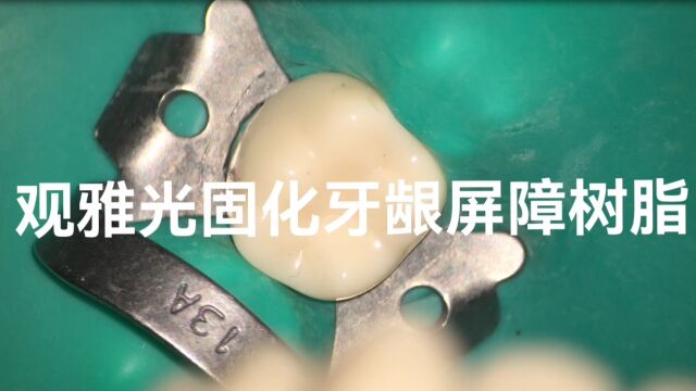 观雅光固化牙龈屏障树脂操作演示