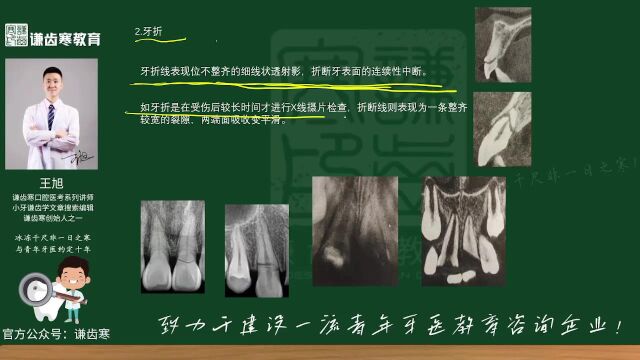 2023年口腔执业含助理医师资格考试——X线