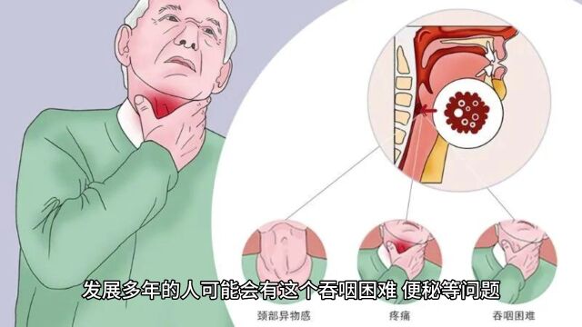 手抖、腿抖如筛糠的人一定是帕金森吗?不见得吧!