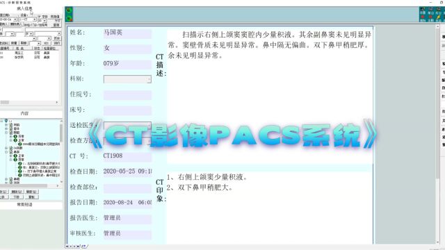 医院综合影像科室工作站PACS系统实现