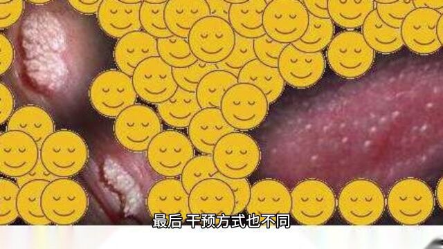 珍珠疹和HPV的区别,何亚习讲解HPV科普知识