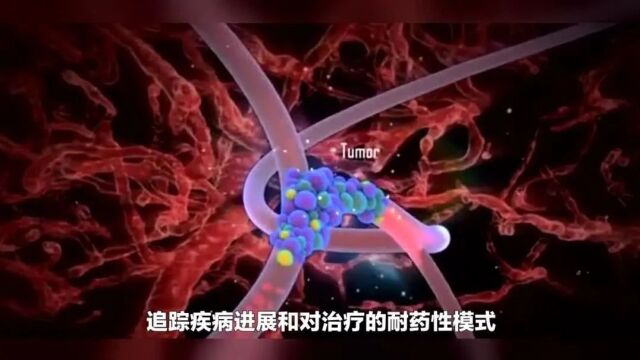 Cell:肿瘤转移的主要机制及治疗机会点(视频版)