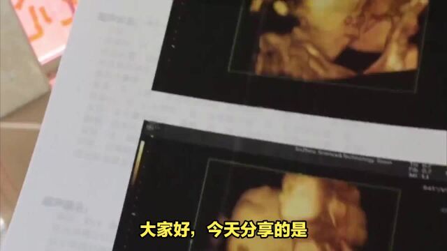 四维彩超AI绘画:预测宝宝模样新项目,门槛低操作简单