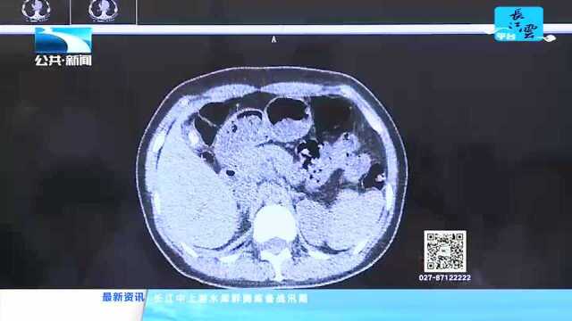 湖北省首例5G网络远程协同手术成功实施