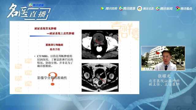 《名医大讲堂》284期 张耀光 无痛血尿一隐形的危险