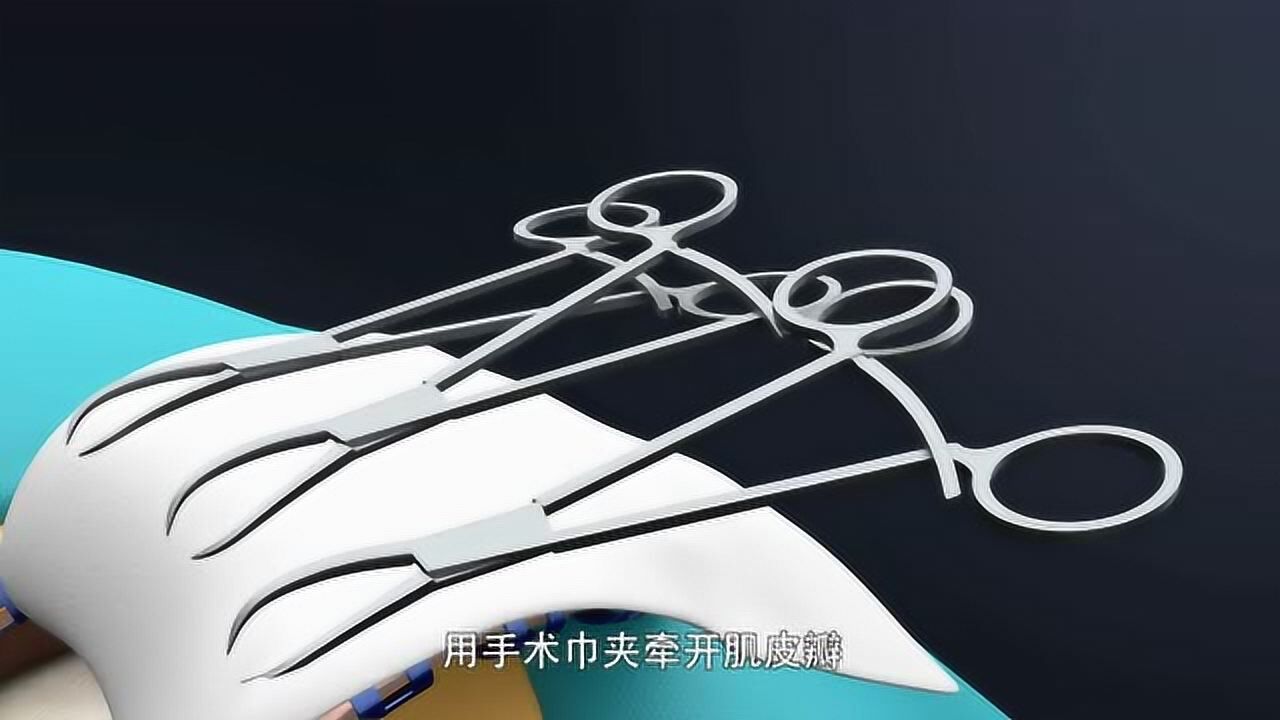 _高清1080P在线观看平台_腾讯视频