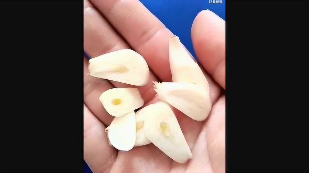 大蒜可真是个好东西,补肾的同时,居然还可以祛除瘊子