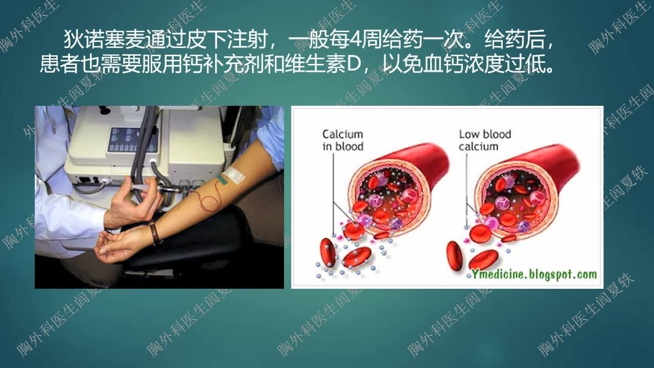 骨转移的全身治疗双膦酸药物狄诺塞麦