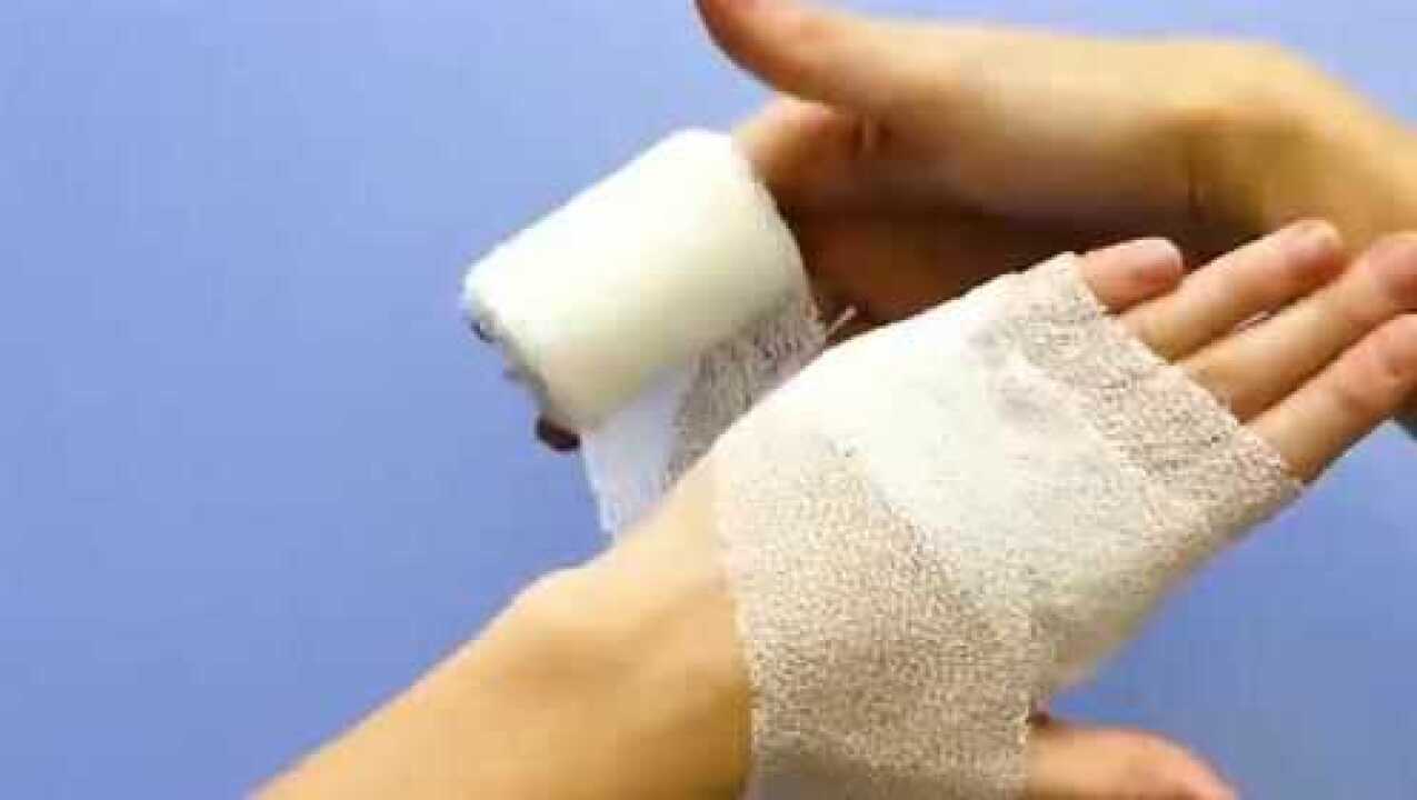 手部受伤正确的处理方法,这样做不但包扎的牢固还舒服_高清1080P在线观看平台_腾讯视频