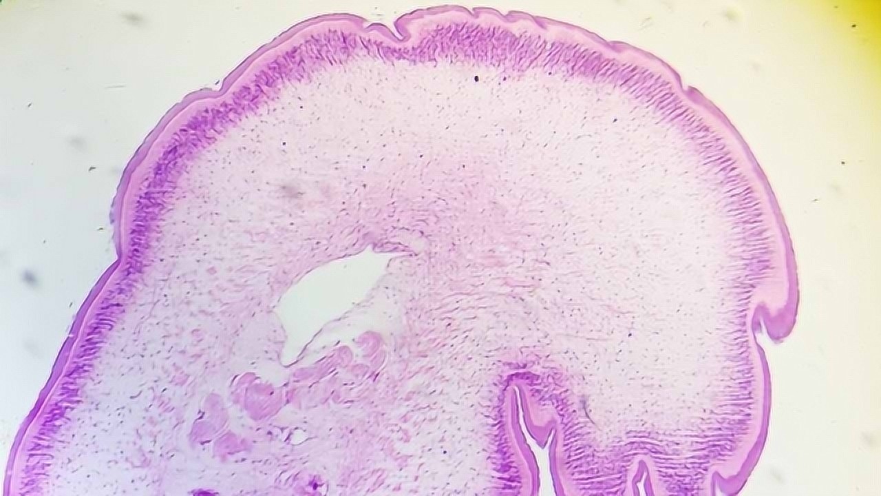 显微镜下的绦虫标本,值得一看