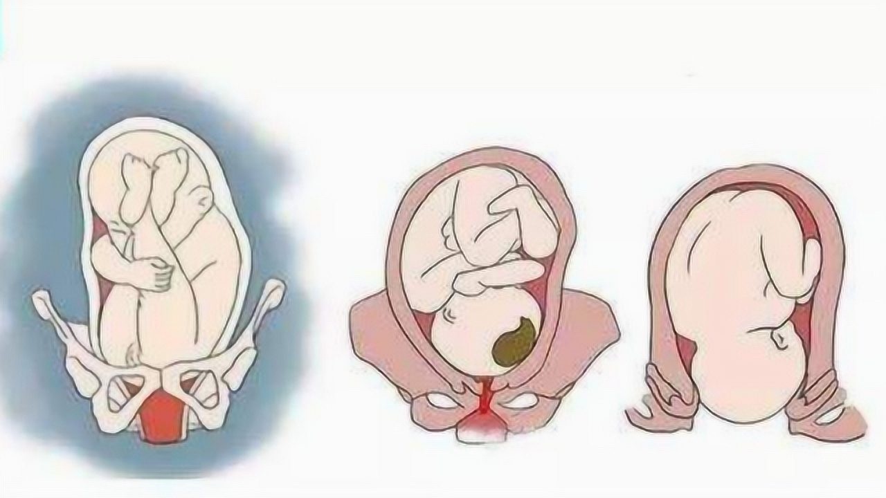 女人生孩子有多疼?3D动画模拟全过程,老公们看完会自责_腾讯视频