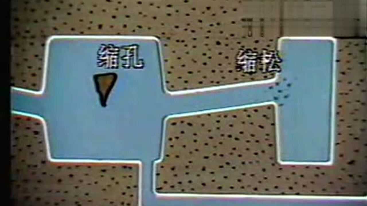 铸造缺陷之一:缩孔和缩松_腾讯视频