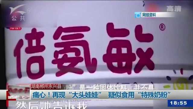 痛心!再现“大头娃娃”疑似食用“特殊奶粉”