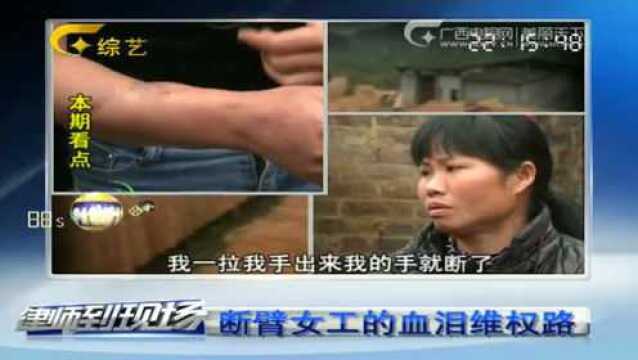 女工人干活发生意外,手臂被机器绞伤,伤处不忍直视