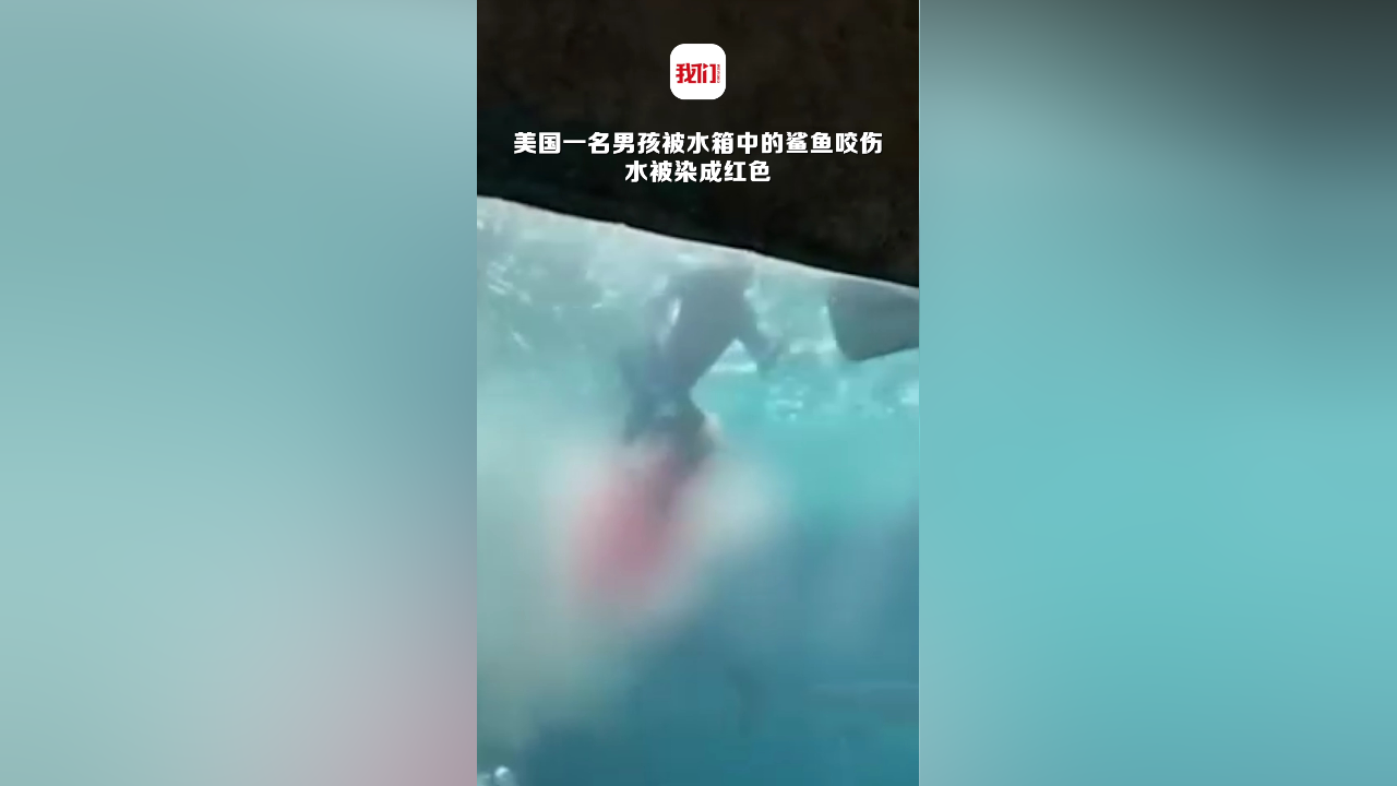美国一名男孩被水箱中鲨鱼咬伤的画面曝光水被染成红色