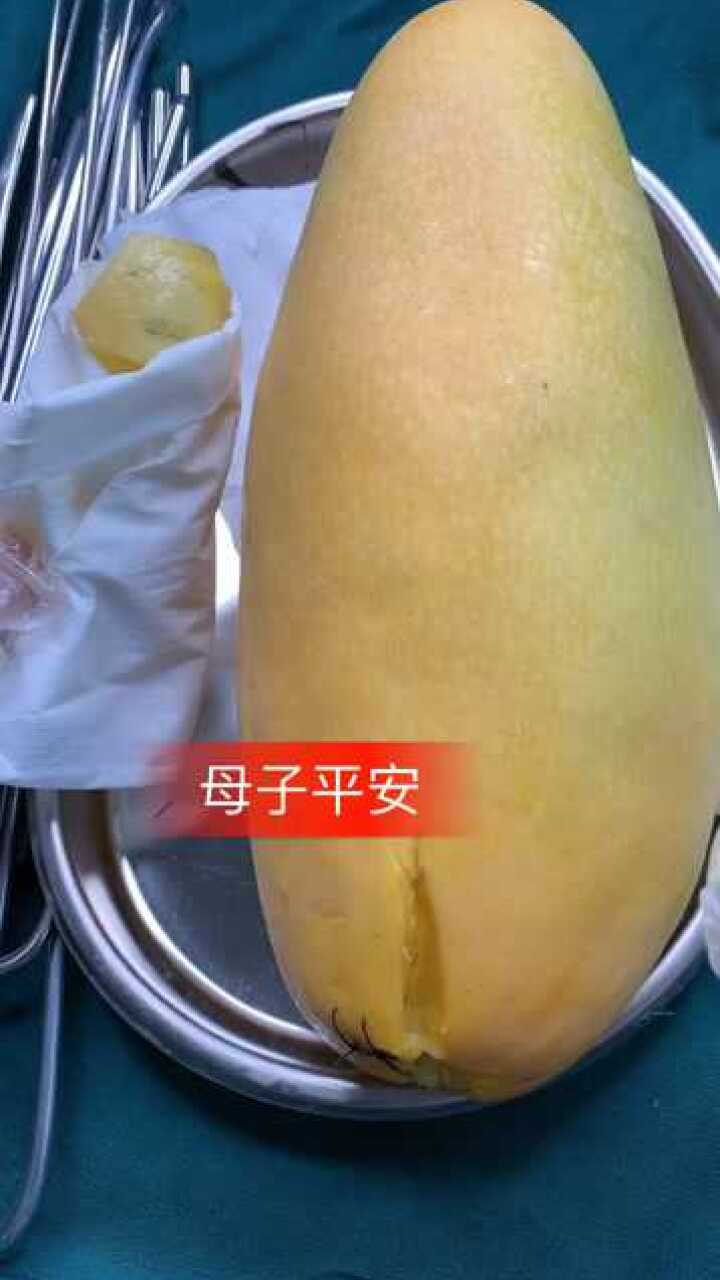 侧切全过程，真实还原_高清1080P在线观看平台_腾讯视频