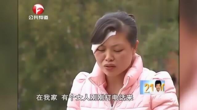 丈夫家暴善于伪装,不是看到妻子伤痕累累的照片,谁也不敢相信