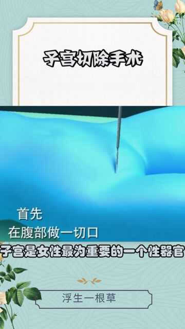 子宫切除手术过程没有子宫那都不算是完整的女人了