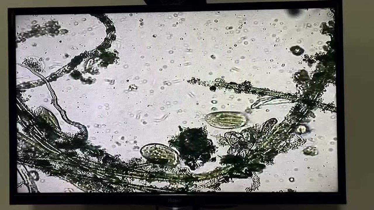 分享一下显微镜下的寄生虫