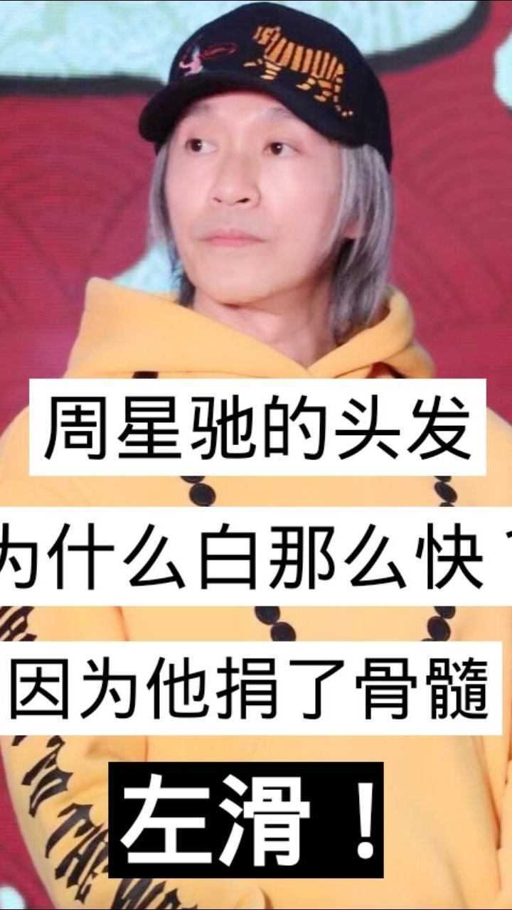 周星驰的头发为什么白的那么快因为他捐了骨髓