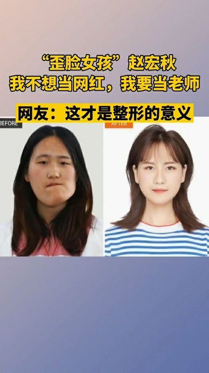 歪脸女孩赵宏秋我不想当网红我要当教师