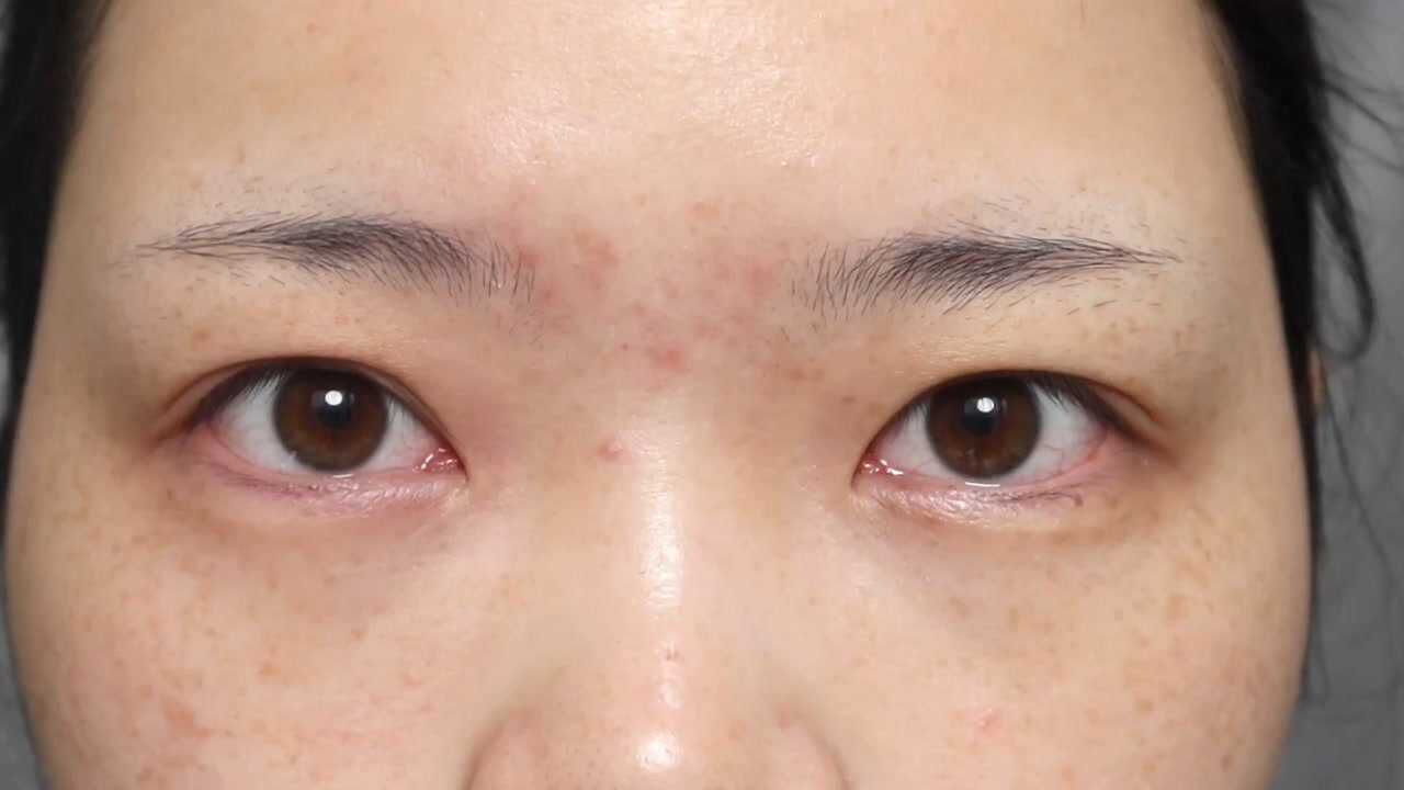 内双 肿眼泡消肿眼妆