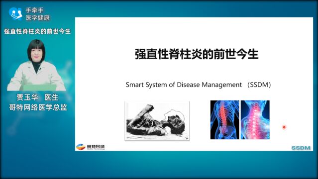 强直性脊柱炎的前世今生