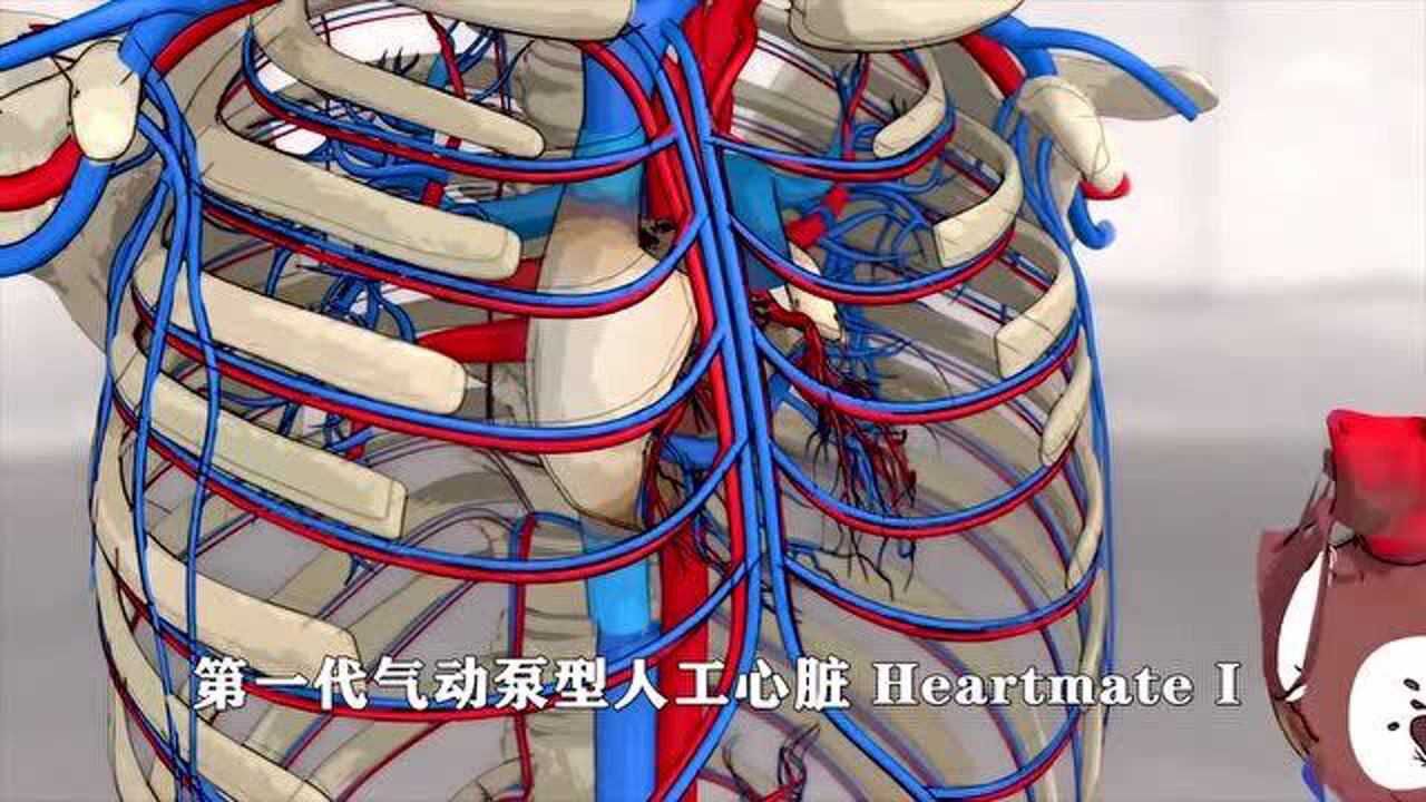 国产全磁悬浮人工心脏不到180克不输世界顶级人工心脏