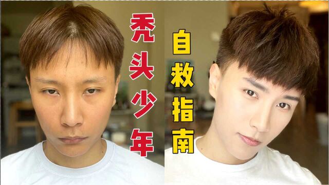 秃头少年自救指南,一片假刘海拯救一张脸?你信吗?