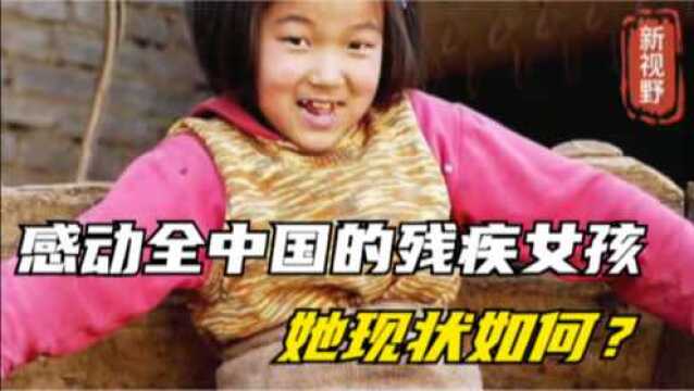 一场车祸失去双腿,20年前感动全中国的残疾女孩,她现状如何?