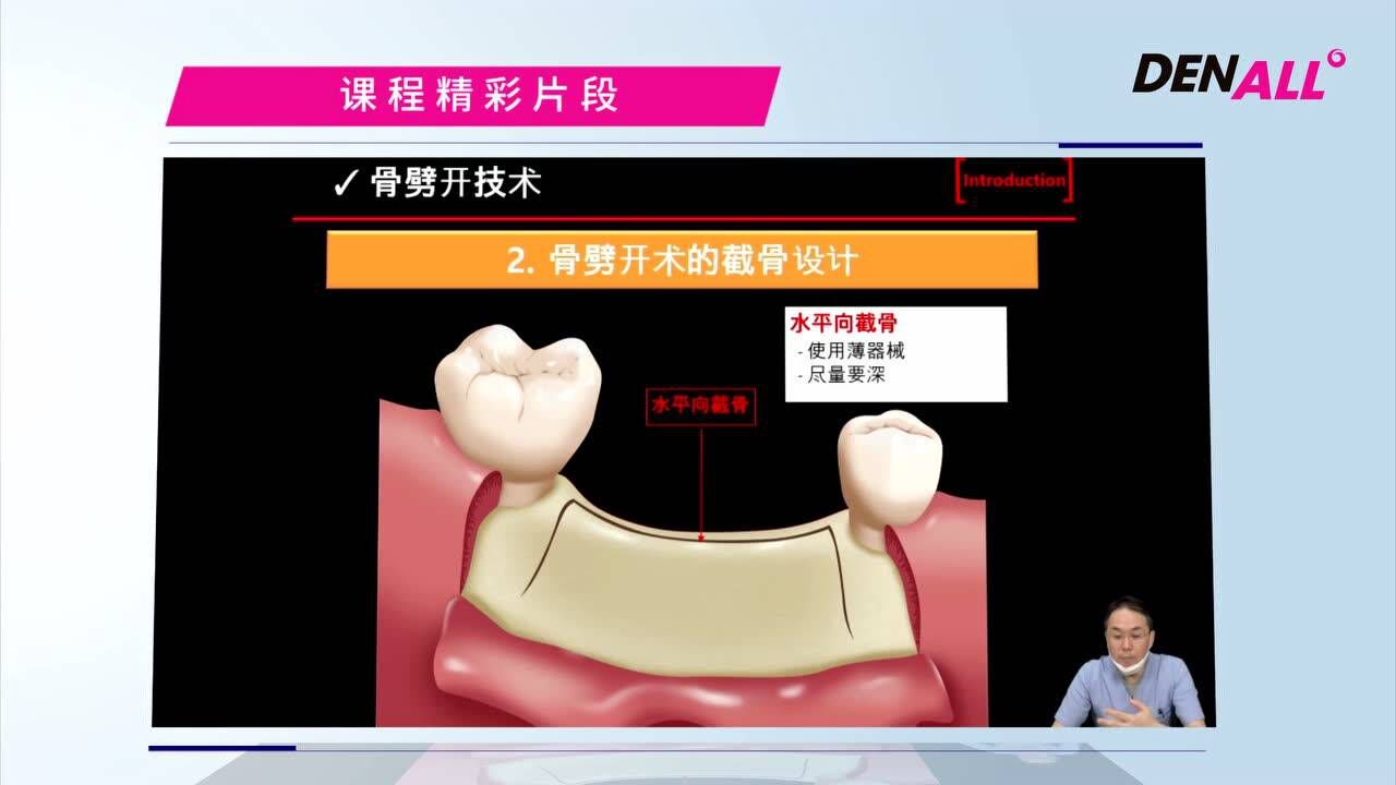 传统&改良的骨劈开技术1、骨劈开技术介绍（精彩片段）_高清1080P在线观看平台_腾讯视频