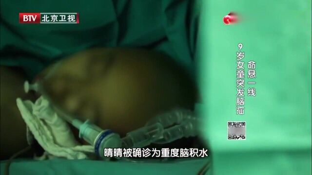 重度脑积水!9岁女童突发脑疝,生命已经逼近终点