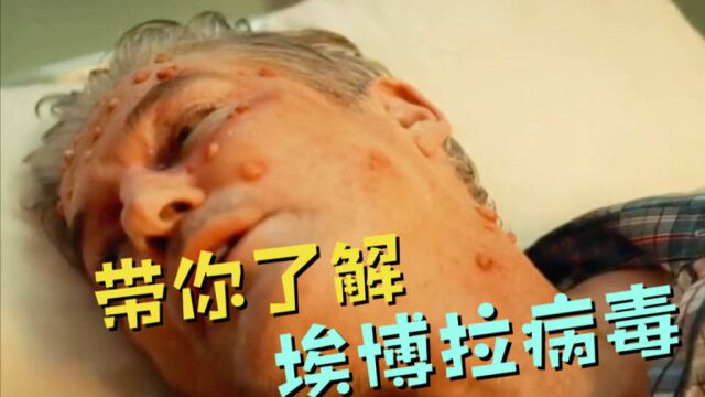 带你了解,埃博拉病毒