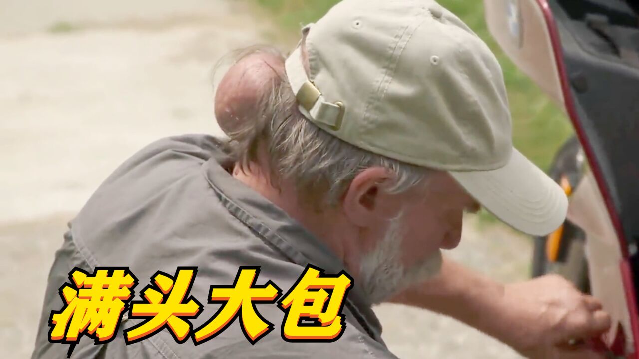 67岁大爷满头大包,一颗就有2斤重,切开直接喷黑水!