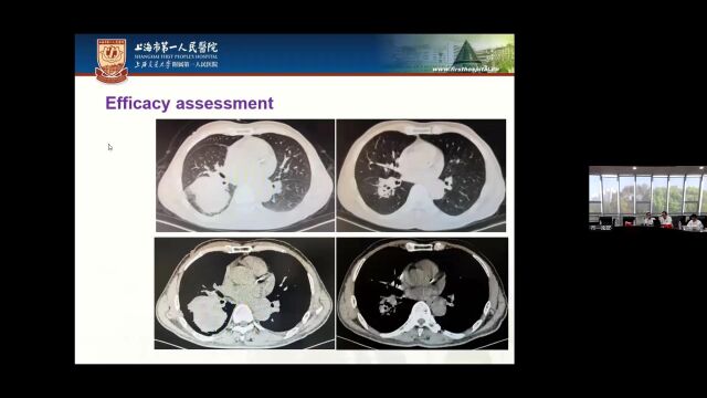 ShanghaiParis Thoracic Surgery Forum