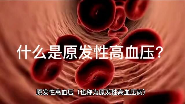 什么是原发性高血压? #高血压 #医学科普