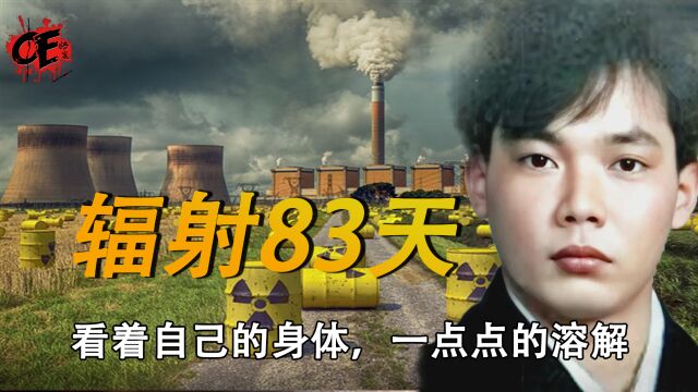 日本工人被核辐射,83天后身体一点点溶解,东海村核临界事件!