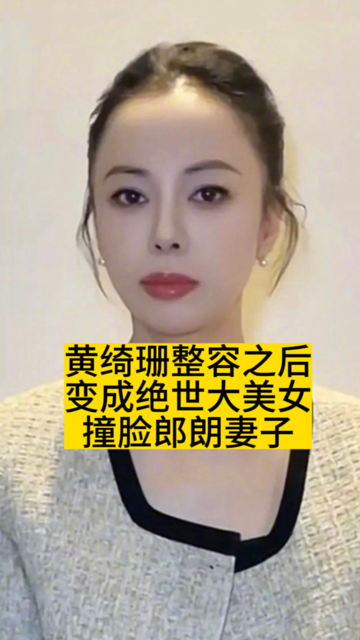 黄绮珊整容之后变成绝世大美女,撞脸郎朗妻子