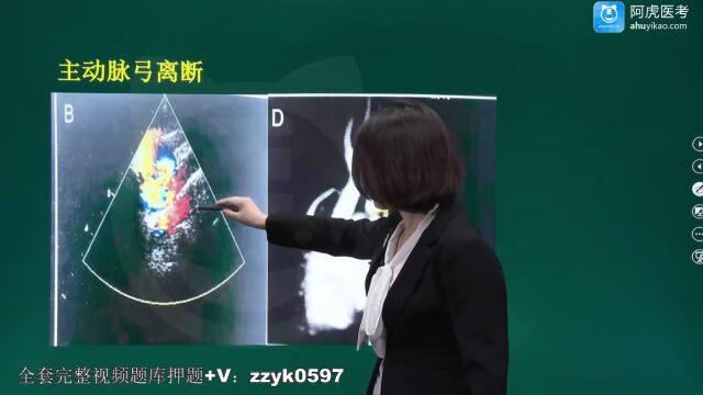 2024年阿虎医考054超声医学技术正高主任医师考试视频课程题库历年真题先天性心脏病03(new)bgk