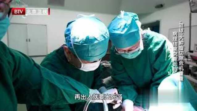 42岁高龄产妇身怀三胞胎 胎儿生长受限面临早产风险视频素材