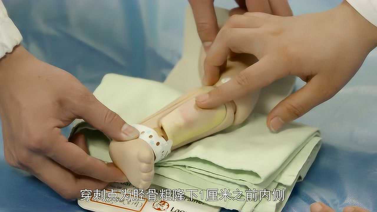 儿科医院小儿胫骨穿刺操作视频