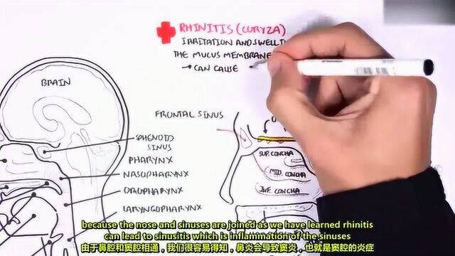 科普鼻腔及鼻窦解剖,话说手绘真的不错呢