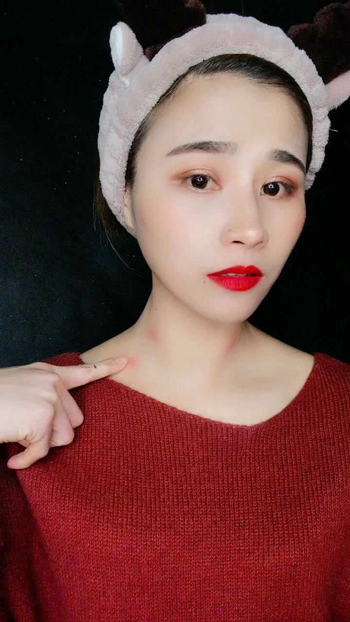 脖子上草莓印太明显怎么办