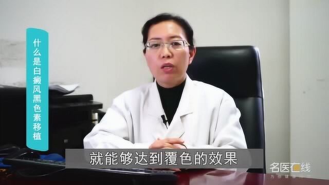 什么是白癜风黑色素移植