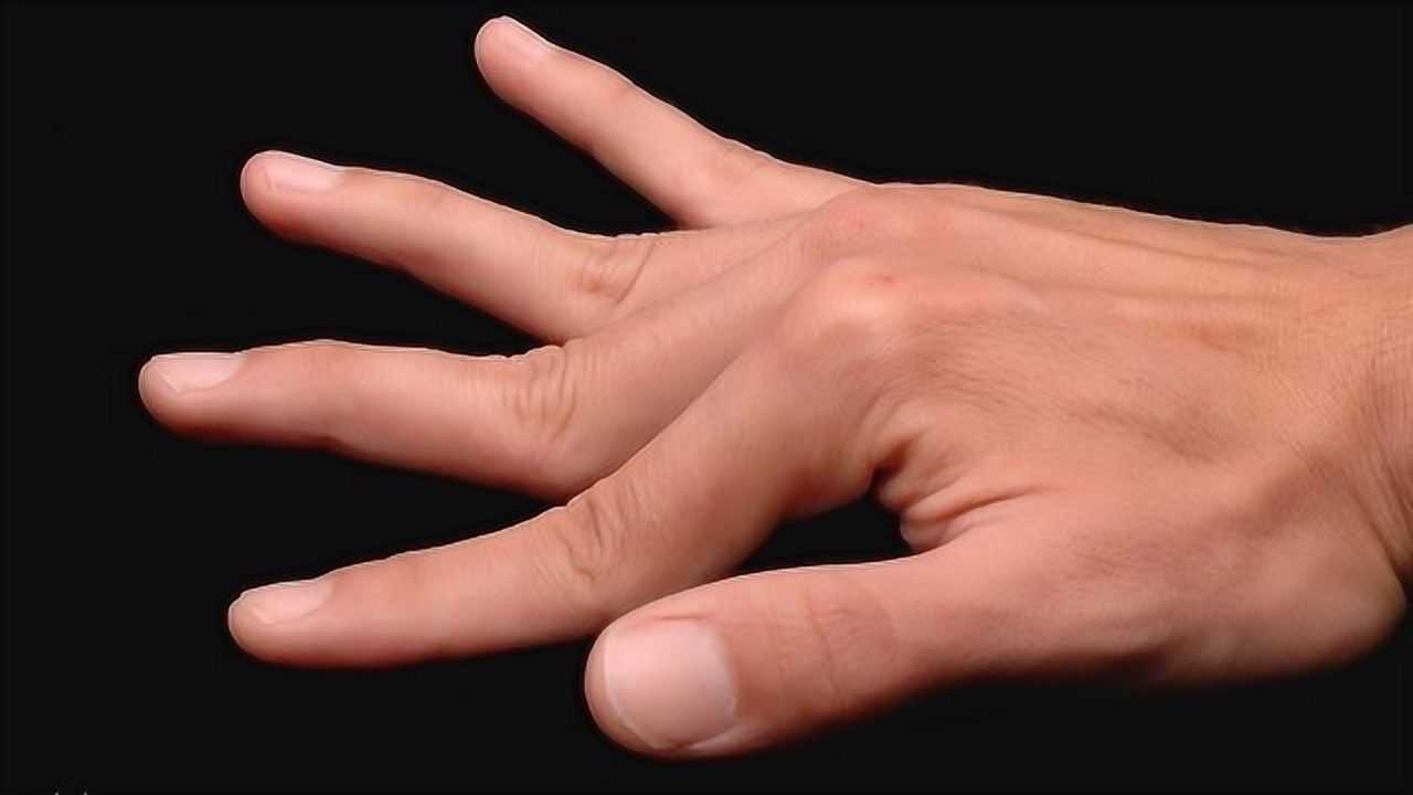 有没有糖尿病看手就知道,手上若有4个异常,十有八九糖尿病来了