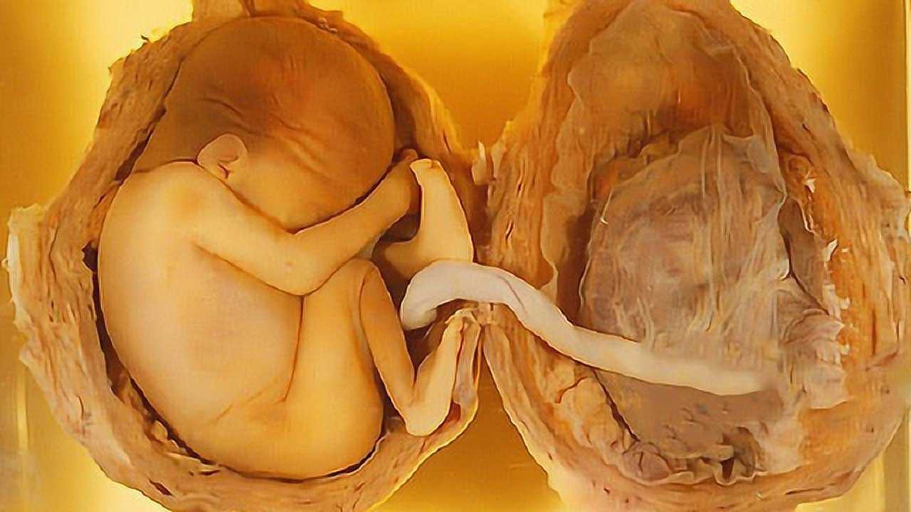 婴儿胎盘图片图片