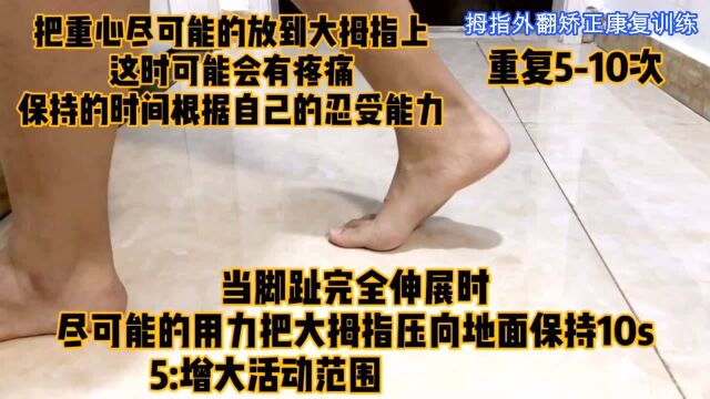 跟我做这个几个动作帮你矫正拇指外翻