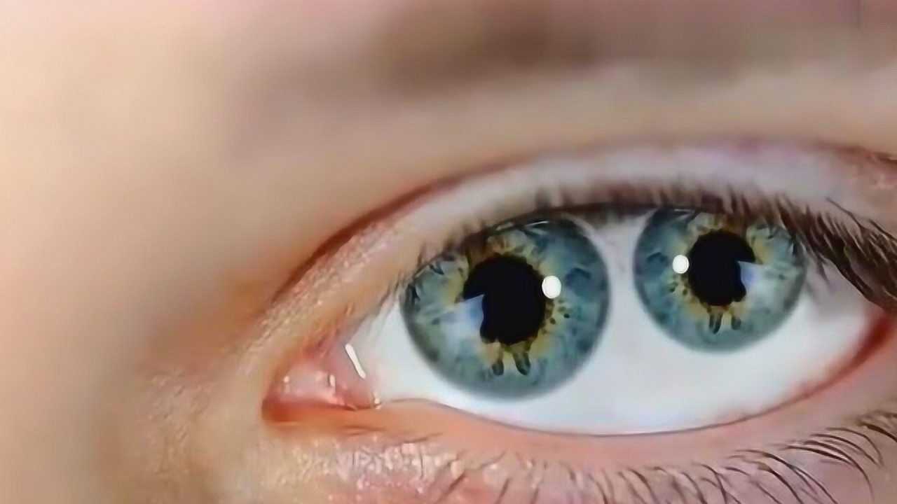 拥有双瞳孔的人真的能看到常人看不到的东西真相令人意外